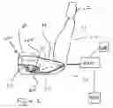 Fig. 02 - Passenger protecting system