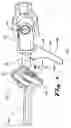 Fig. 04 - Decoupler deflector devices and systems for automobile steering systems