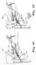 Fig. 05 - Decoupler deflector devices and systems for automobile steering systems