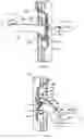 Fig. 08 - Gravity actuated retrieval device