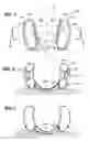 Fig. 02 - Head rest