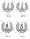 Fig. 03 - Field emission device and a method of forming such a device