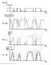 Fig. 06 - Ultrasonic motor device
