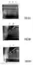 Fig. 06 - Multiscale localization procedure