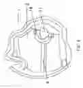 Fig. 03 - Low-level oil sensor