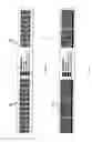 Fig. 10 - Bar coded wristband