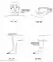 Fig. 17 - Wearable/portable protection for a body