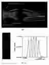 Fig. 08 - Apparatus and method of electrophotographic printing employing diffusive light sources and apparatus and method of scanning a document