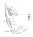 Fig. 02 - SIDE GUARDS FOR EYEGLASSES