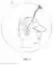 Fig. 06 - Eyewear retention device