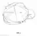 Fig. 09 - Eyewear retention device