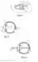 Fig. 02 - Method and apparatus for aligning a mask with the visual axis of an eye