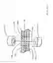 Fig. 37 - Device and method for in vitro determination of analyte concentrations within body fluids