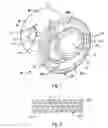 Fig. 02 - Decorative lens