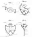 Fig. 02 - BEATER APPARATUS AND METHOD