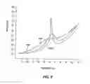 Fig. 09 - Method and system for external assessment of hearing aids that include implanted actuators