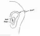 Fig. 01 - Multi-coil coupling system for hearing aid applications