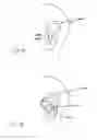 Fig. 11 - Multi-coil coupling system for hearing aid applications