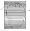 Fig. 01 - Registration of three dimensional image data with X-ray imaging system