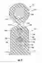 Fig. 10 - Fiber optic cables that are separable for optical fiber access