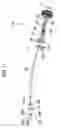 Fig. 11 - Cleaning implement