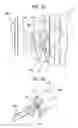 Fig. 18 - Cleaning implement