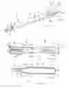 Fig. 02 - Toothpaste dispensing toothbrush