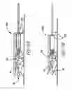 Fig. 10 - Device for securing a personal-transport vehicle to a mounting surface