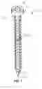Fig. 02 - Variably threaded screw