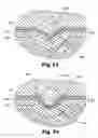 Fig. 15 - Sample processing devices and carriers