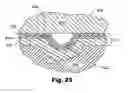 Fig. 16 - Sample processing devices and carriers