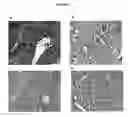 Fig. 03 - Cytotoxicity mediation of cells evidencing surface expression of CD63