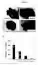 Fig. 11 - Cytotoxicity mediation of cells evidencing surface expression of CD63