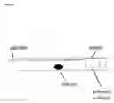 Fig. 03 - Non-lithotripsic kidney-stone therapy