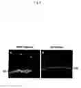 Fig. 09 - XIAP therapy