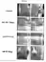 Fig. 15 - Inhibitor proteins of a protease and use thereof