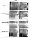 Fig. 16 - Inhibitor proteins of a protease and use thereof