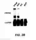 Fig. 04 - Androgen-regulated PMEPA1 gene and polypeptides