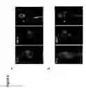 Fig. 07 - Humanized anti-prostate stem cell antigen monoclonal antibody