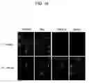 Fig. 35 - Human histone deacetylase, HDAC9c