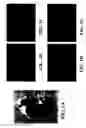 Fig. 02 - Reduction of embryonic neural tube defects by pre-or early-administration of germination-activated sporoderm-broken ganoderma lucidum spores to pregnant female