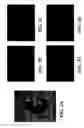 Fig. 03 - Reduction of embryonic neural tube defects by pre-or early-administration of germination-activated sporoderm-broken ganoderma lucidum spores to pregnant female
