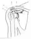 Fig. 01 - Method of repairing tendons by surgery