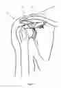 Fig. 02 - Method of repairing tendons by surgery