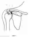 Fig. 05 - Method of repairing tendons by surgery