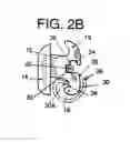 Fig. 03 - Orthodontic bracket