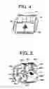 Fig. 05 - Orthodontic bracket