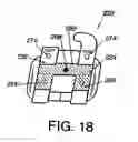 Fig. 13 - Orthodontic bracket