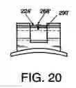 Fig. 15 - Orthodontic bracket