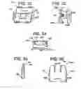 Fig. 20 - Orthodontic bracket